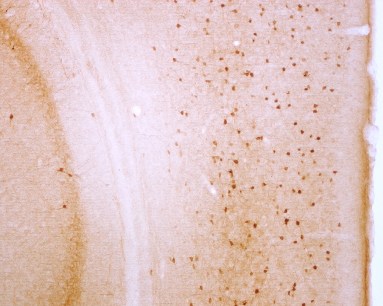 Goat anti-Parvalbumin Antibody