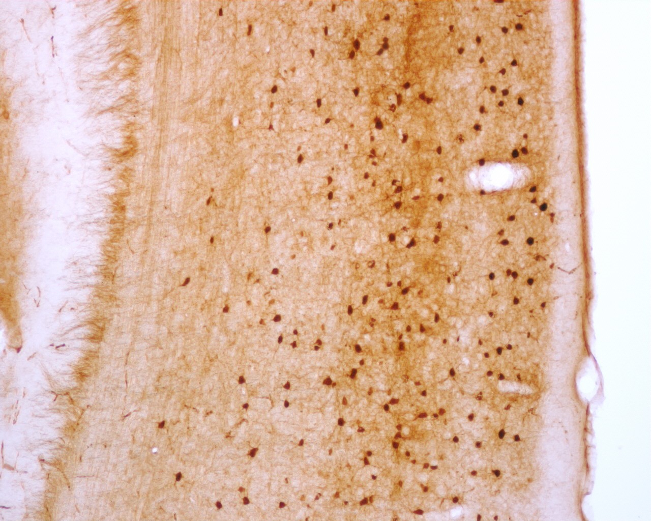 Monoclonal anti-Parvalbumin Antibody Ascitic Fluid