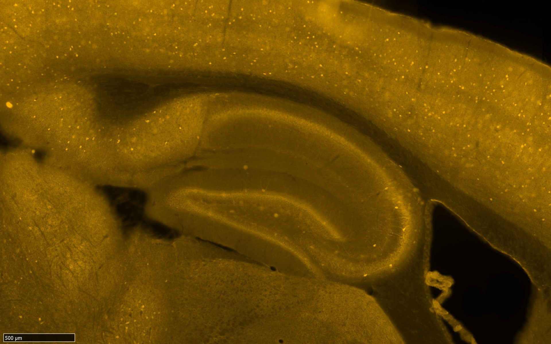 Rabbit anti-Parvalbumin Antibody