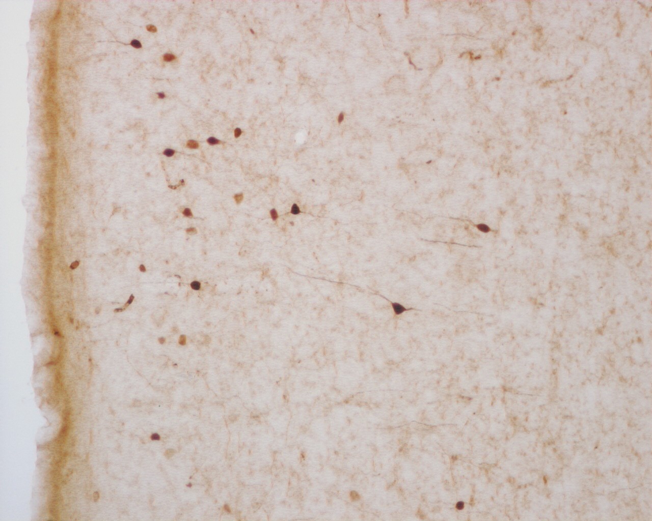 Monoclonal anti-Calretinin Antibody