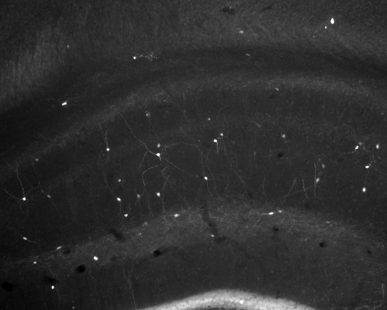 Guinea pig anti-Calretinin Antibody