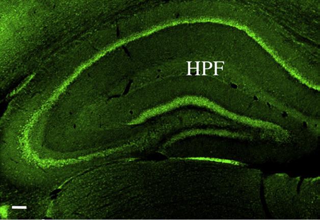 Rabbit anti-Tescalcin Antibody